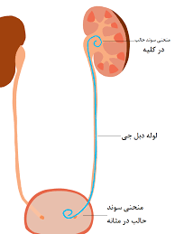 مراقبت بعدازخروج دبل جی